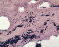 0269 alpha star Nielsen 3