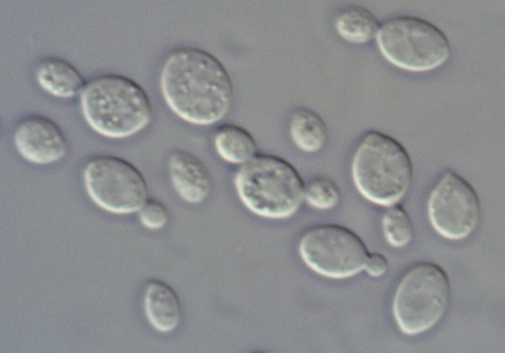 yeast cells