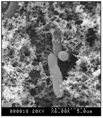 a magnified image of a yeast