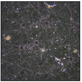 black, brown, and orange microscopic fungus structures on a grape leaf surface