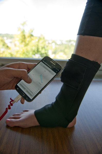 Washington State University researchers have developed a “smart” sock to track ankle edema, a symptom of many serious medical conditions, at home.