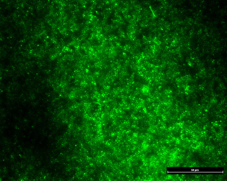 Slide showing high levels of bacteria.