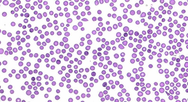 Bovine red blood cells infected with Babesia bovis.
