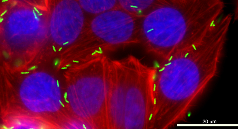 “Campylobacter jejuni (green) is shown infecting a human cell. The bacteria account for 400 to 500 million cases of diarrhea annually.”
