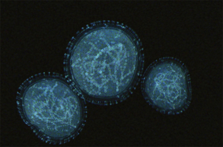 Microscopic image of the monkeypox virus.