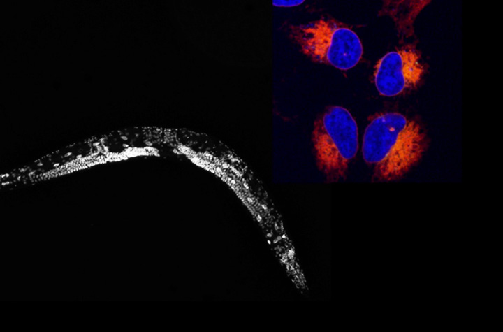 The researchers tested the effect of the fatty acid on germ cells in a nematode worm and on human cancer cells.