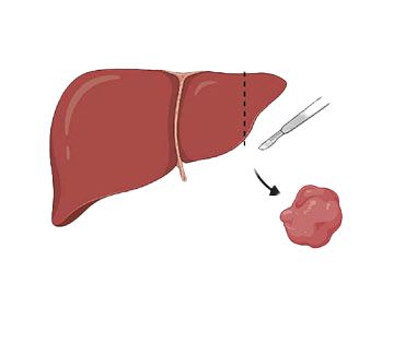 Artistic drawing of tissue with a piece of it being cut away so that it can be analyzed.