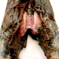 Grade II underrunning of hoof capsule of a free-ranging elk.