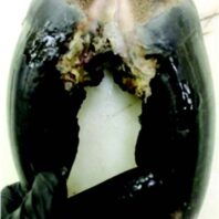 Grade III sole ulcer – cavity in hoof capsule of a free-ranging elk.