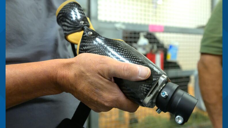 Close up photo of Elsa's prosthetic.