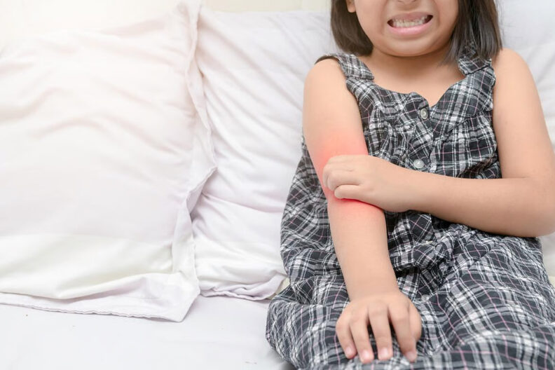 Young girl wearing blue and white plaid dress is scratching her arm near her elbow.