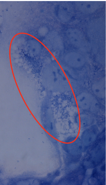 P. salmonis in tissue culture. Image provided by Dr. Kevin Snekvik.