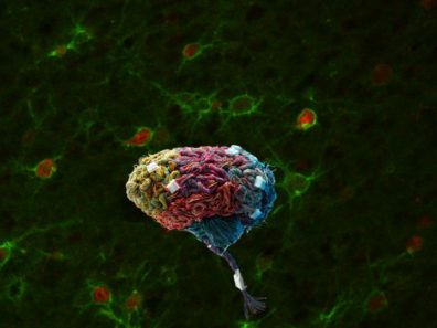 Brain Nets Photo Sorg