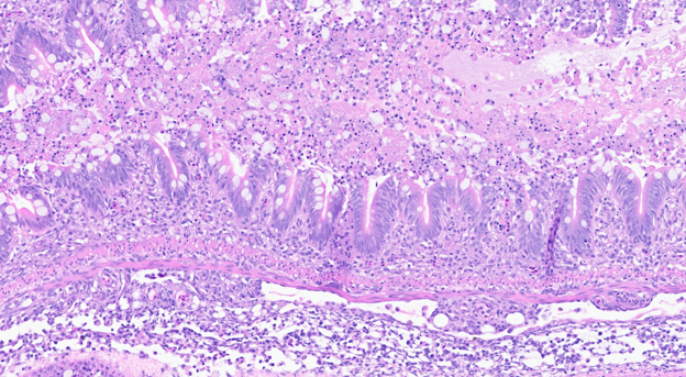 Microscopic photo of description in following paragraph.